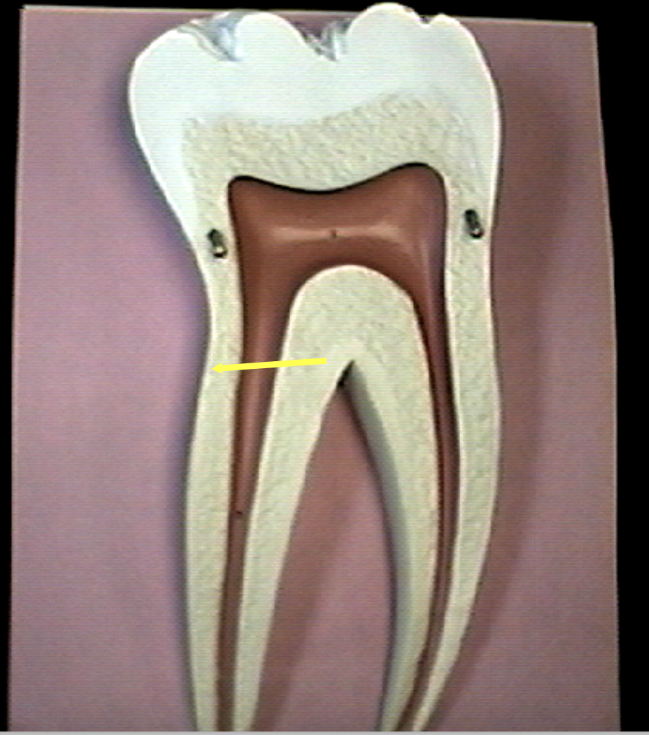 <p>Identify the organs of the digestive tract.</p>