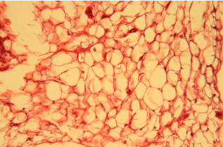 <p>Adipose tissue</p>