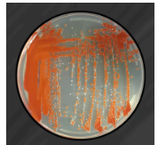<p><span style="background-color: transparent;"><strong>What problem in streaking technique most likely produced the plate shown?&nbsp;</strong></span></p><p><span style="background-color: transparent;"><strong>Answer choices for all examples</strong></span></p><p><span style="background-color: transparent;">A. Failure to flame loop between sections</span></p><p><span style="background-color: transparent;">B. Crossing back into previous section on every streak</span></p><p><span style="background-color: transparent;">C. Forgetting to cross into first section on second streak</span></p><p><span style="background-color: transparent;">D. Forgetting to cross into second section on third streak</span></p><p><span style="background-color: transparent;">E. Not letting the loop cool before taking sample from tube </span></p><p><span style="background-color: transparent;">(Lecture #1-2 Questions)</span></p>