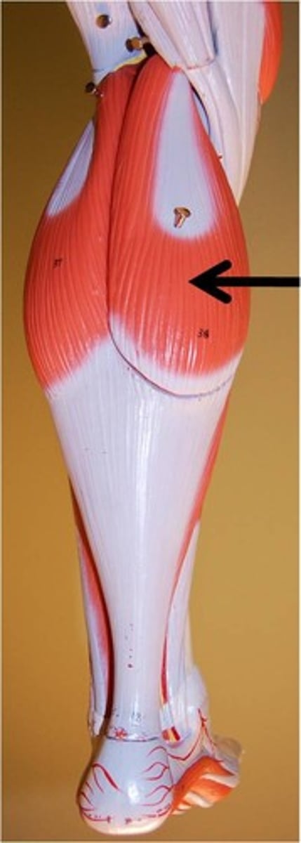 <p>Action - plantarflexion</p><p>Origins - lateral &amp; medial condyle of femur</p><p>Insertion - calcaneus via Achilles tendon</p>
