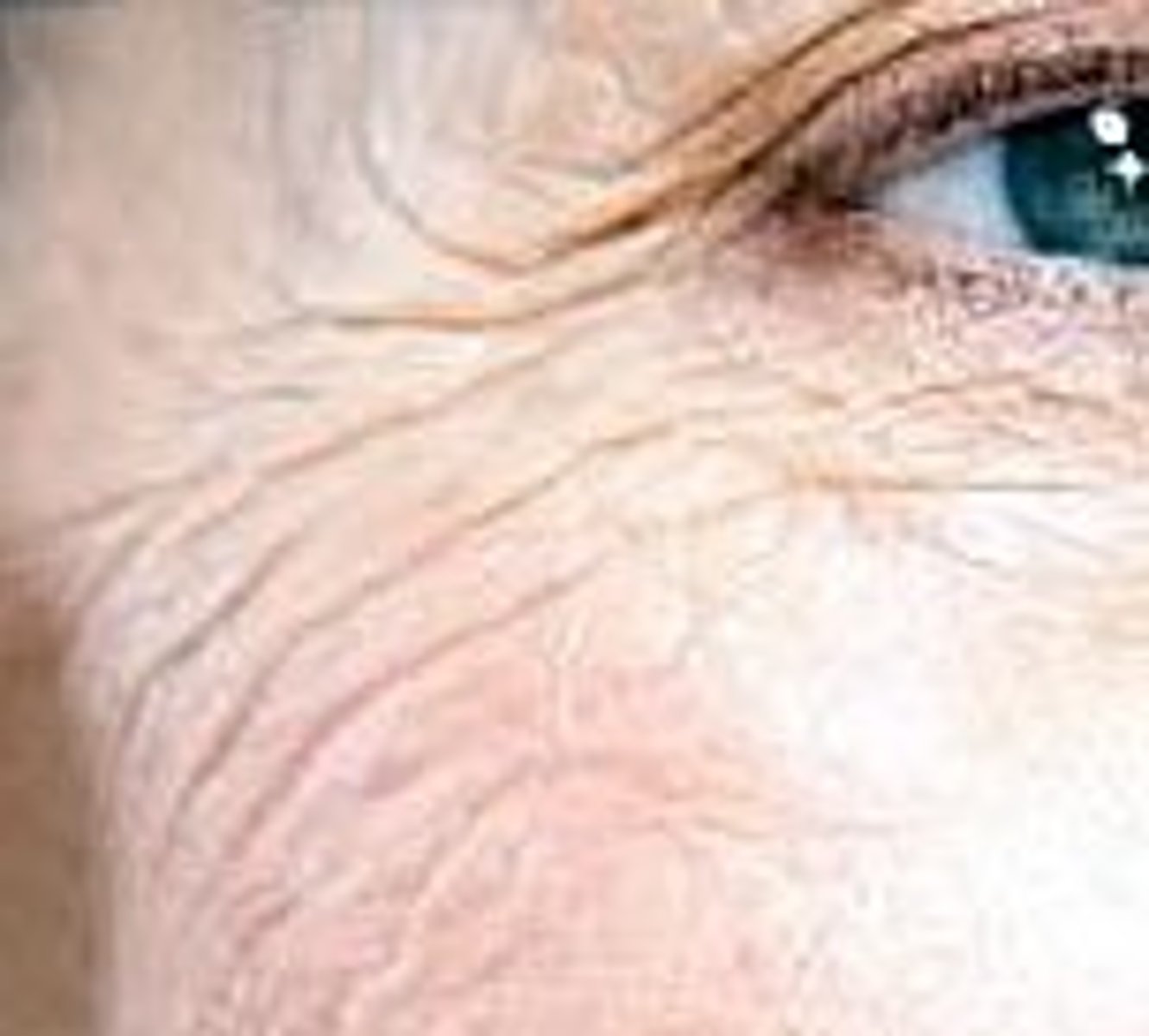 <p>the lines in your skin caused by age. Old people have a lot of wrinkles.</p>