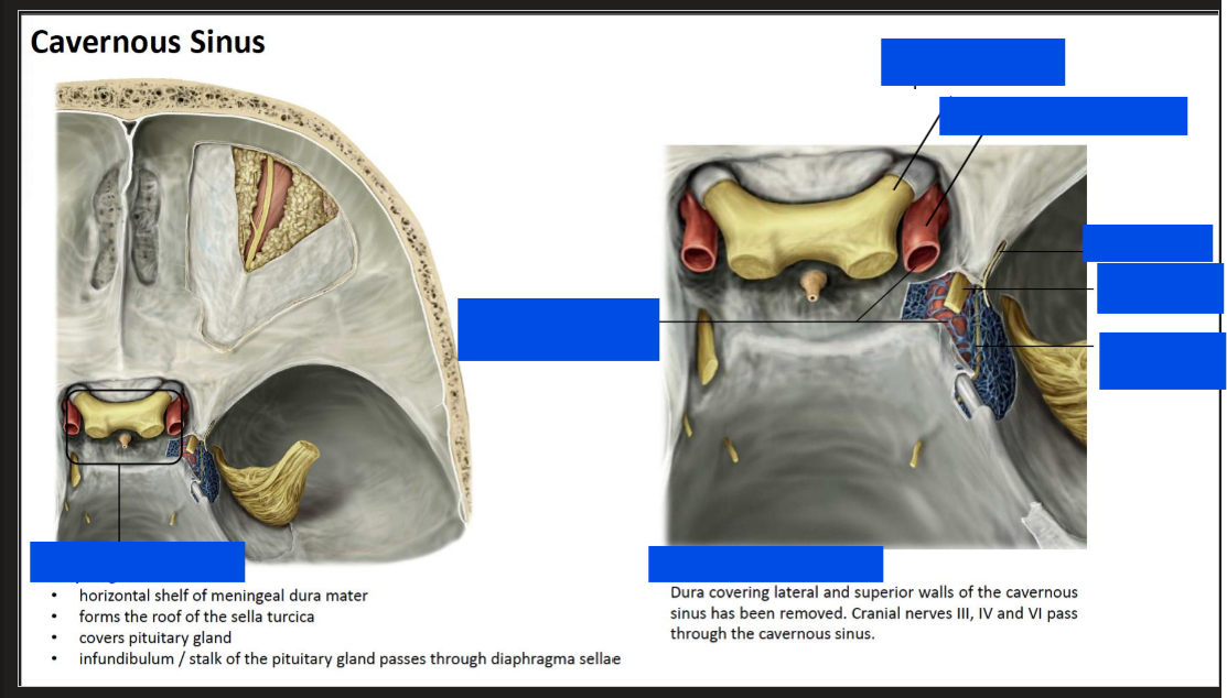 <p>Label the cavernous sinus</p>
