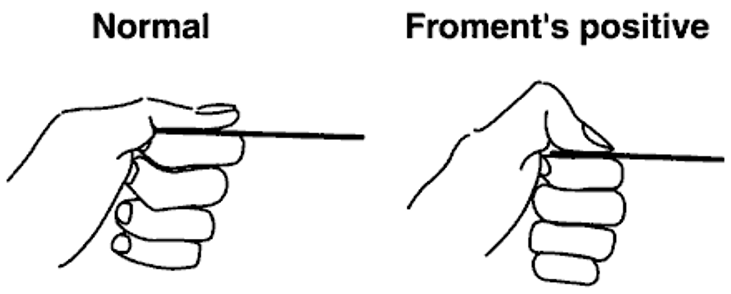 <p>Patient sits/stands &amp; holds a piece of paper between their thumb &amp; index finger</p><p>--examiner tries to pull paper out</p><p>Positive Test = Ulnar n. Compromise</p><p>--flexion of the distal IP joint of the patient's thumb</p>