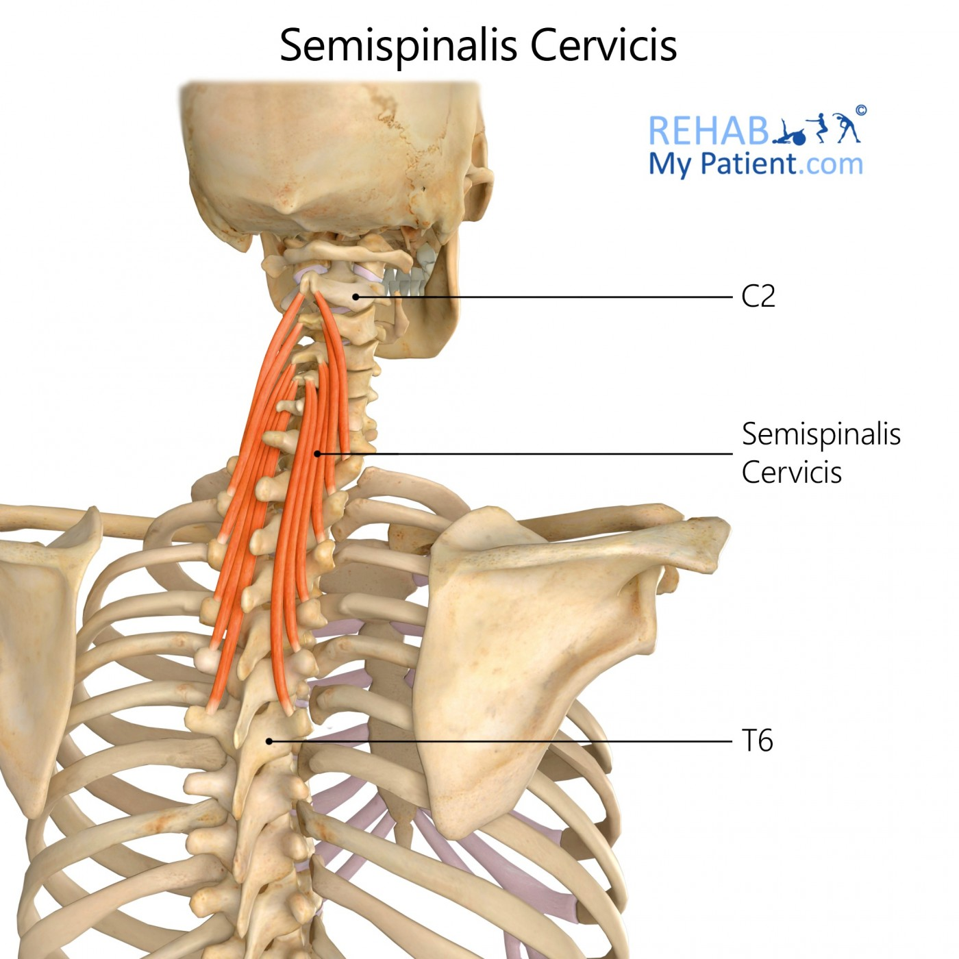 <p>semispinalis cervicis</p>