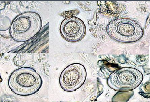 <p>Keywords for Hymenolepsis nana or Hymenolepsis diminuta</p>