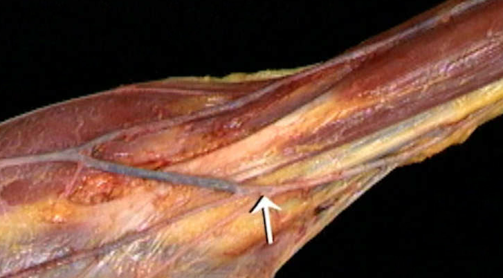 <p>Oppervlakkige vene</p>