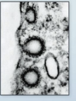 <p>type of Endocytosis</p><p><strong>Specific receptors for cargo </strong>into and within a cell</p><p>100-150nm</p>