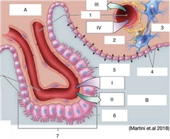<p>What is entering at IV?</p>