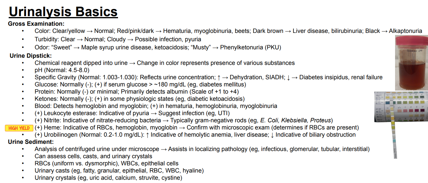 <p>Answer: When serum glucose exceeds approximately 180 mg/dL.</p><p>Extra Information:</p><ul><li><p>Urine glucose is normally negative.</p></li><li><p>Diabetes mellitus is an example associated with a positive result.</p></li></ul><p></p>