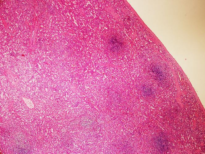 <p>Tiêu bản gì ?</p>