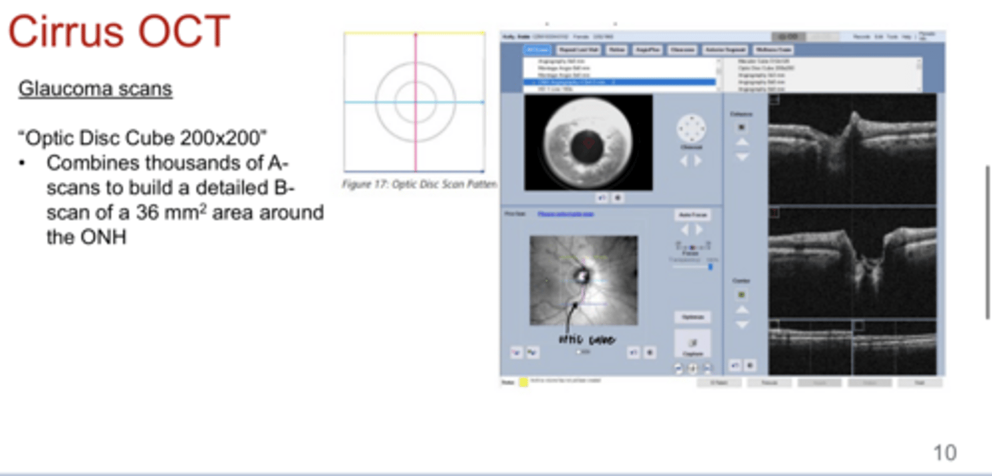 <p>What is the purpose of the Optic Disc Cube 200x200 scan?</p>
