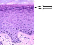 <p>- a layer of the epidermis that marks the transition between the deeper, metabolically active strata and the dead cells of the more superficial strata</p><p>- 3-5 layers of keratinocytes with thickened membrane</p>