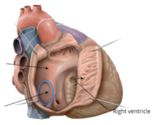 <p>What is circled? </p>