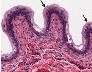 <p><span style="line-height: 16px;">Transitional Epithelium </span></p>