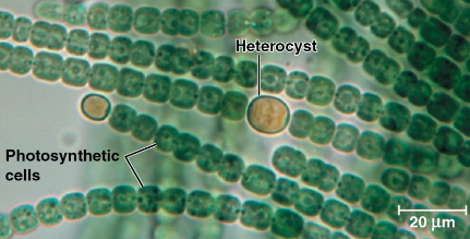 <p>Heterocysts</p>