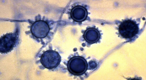 <p>Small narrow yeasts with spiny macrocondida</p>