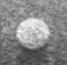 <p>More echogenic, brighter than another structure </p>
