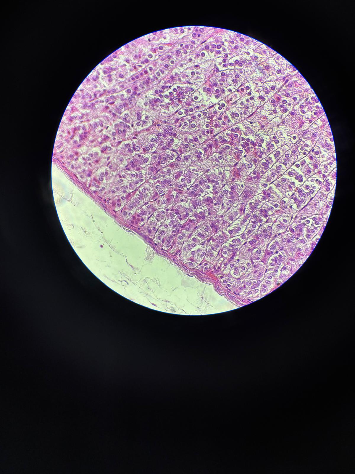 <p>Organ divided into the Zona arcuata (glomerulosa) and Medulary Substance.</p>