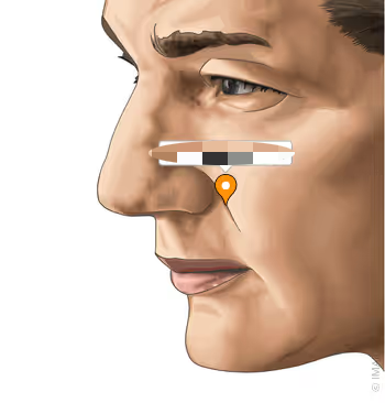 <p>the following picture is what extraoral landmark?</p>