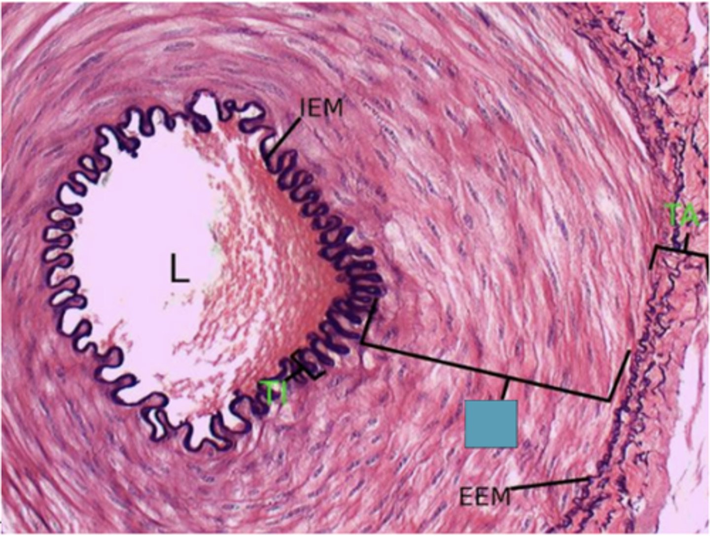 <p>Identify the layer of the vessel</p>