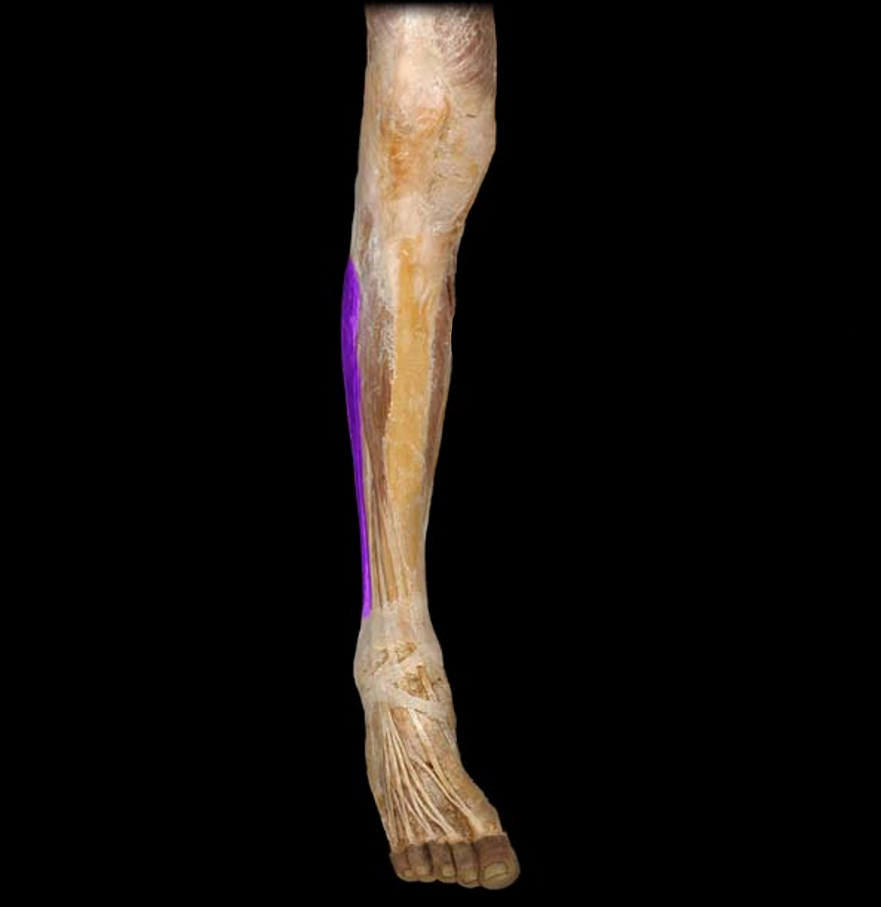 <p>What muscle is this?</p>