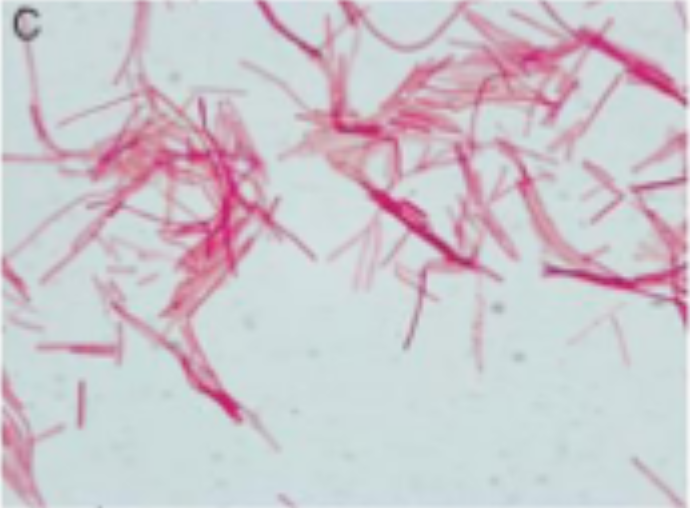 <p>Uses one stain to stain cell, background or bacterial cell </p><ul><li><p>increases contrast → size (can observe the different types if there are different ones), shape, arrangement of cells</p></li><li><p>all cells are stained same color</p><ul><li><p>no differentiation between cell types</p></li><li><p>but we can see that its safranin rod-shaped bacteria and they are connected together in a string (strepto)</p></li></ul></li></ul><p></p>