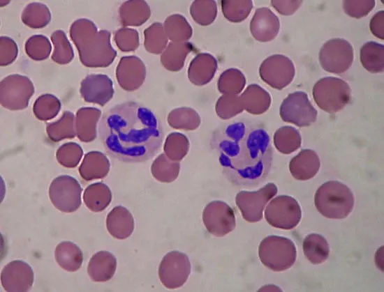 <p>granulocyte</p><p>phagocytosis</p>