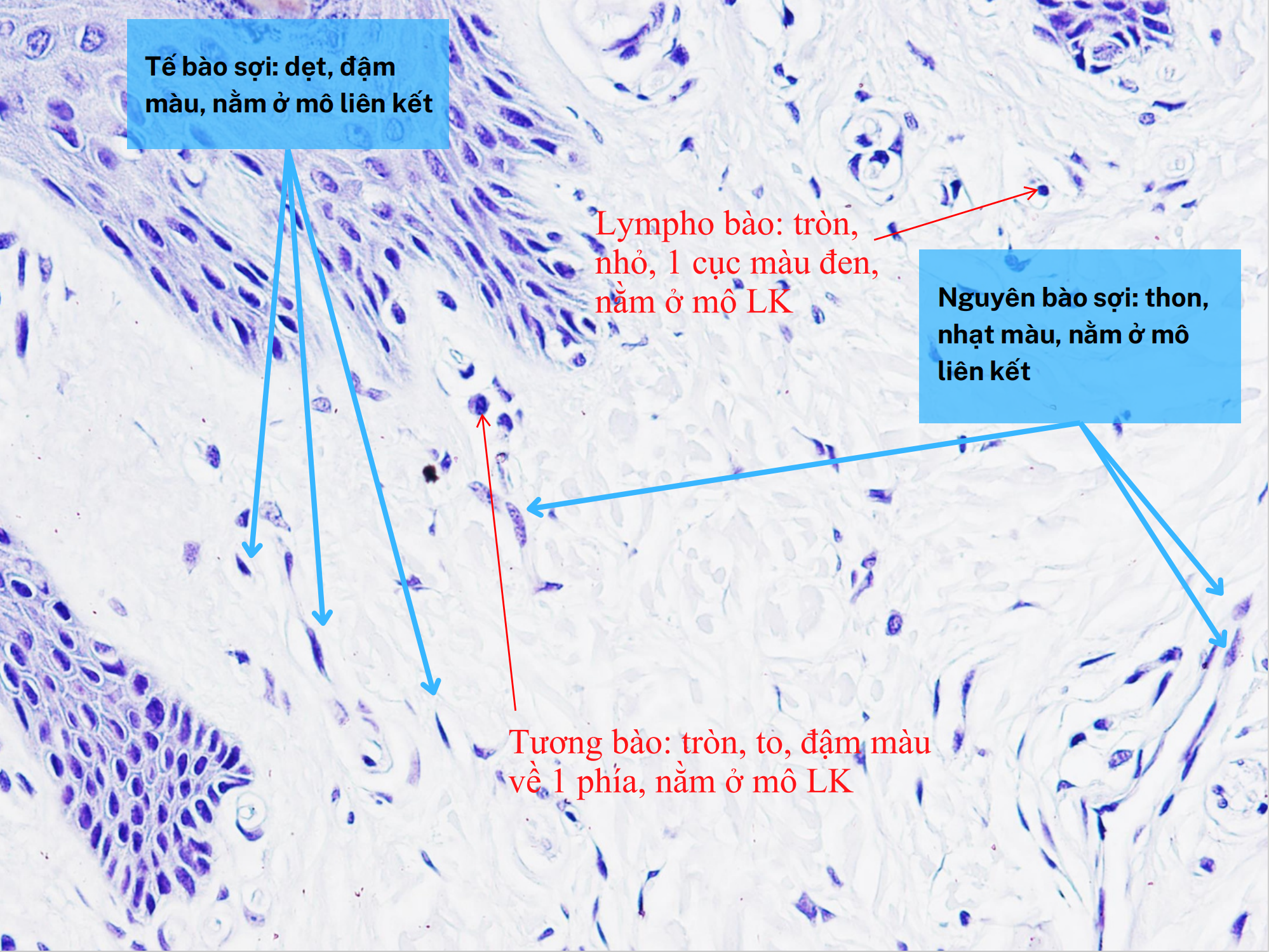 <ol><li><p>Tế bào sợi</p></li><li><p>Lympho bào</p></li><li><p>Nguyên bào sợi</p></li><li><p>Tương bào</p></li></ol><p></p>