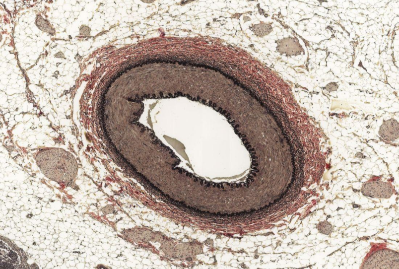 <p>Identify the vessel?</p>