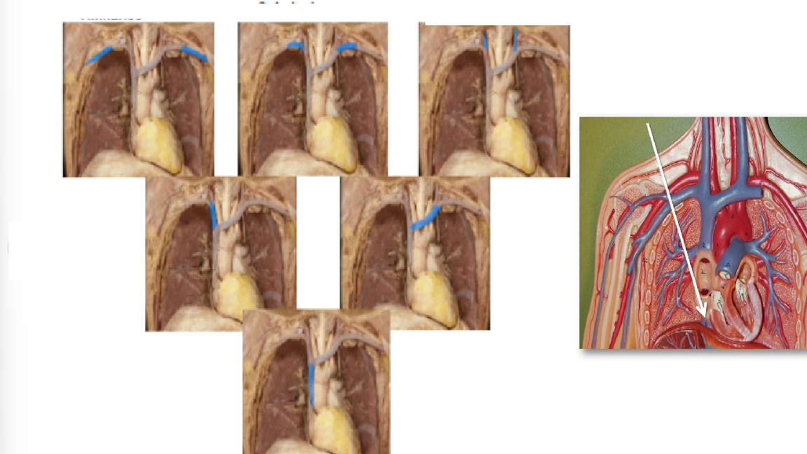 <p>locate the inferior and superior vena cava, vein or artery?</p>