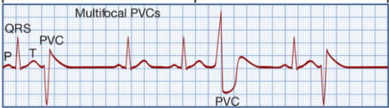<p>What rhythm is this?</p>