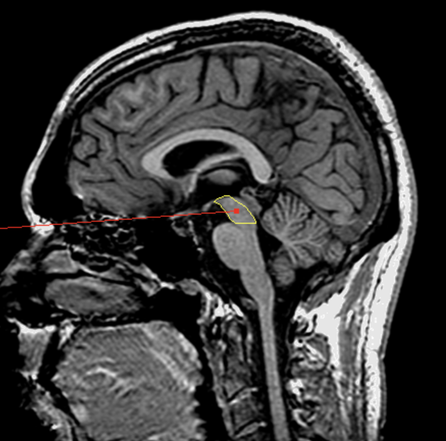 <p>What is the area highlighted called?</p>