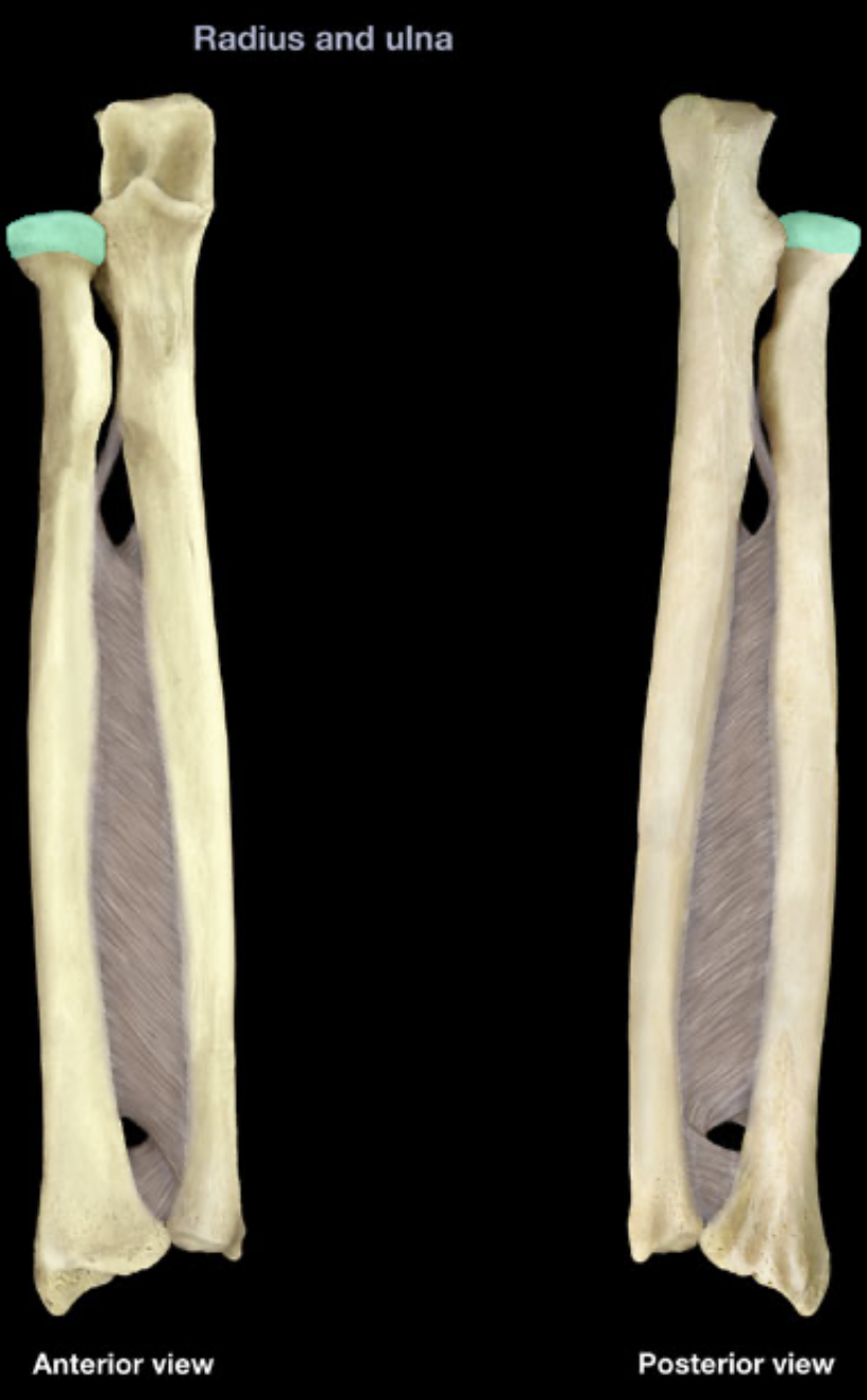 term image