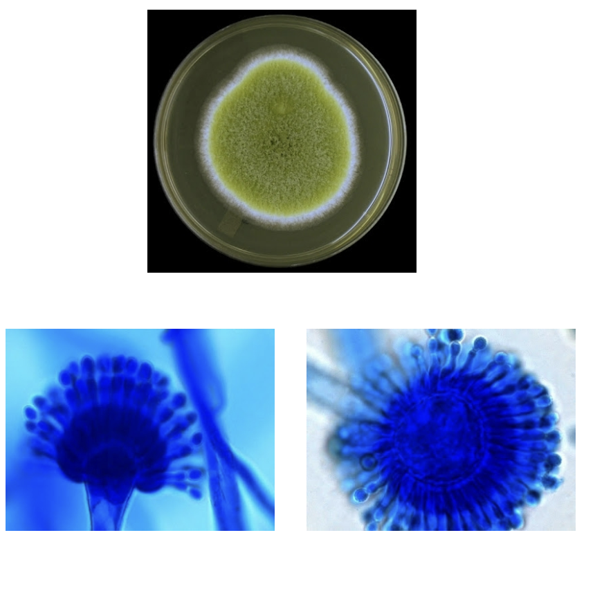 <p>-Yellow-green or olive colonies</p><p>-Circumferential phialides</p>