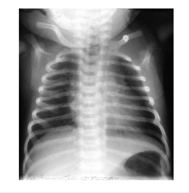 <p>what kind of plain film is attached? </p>