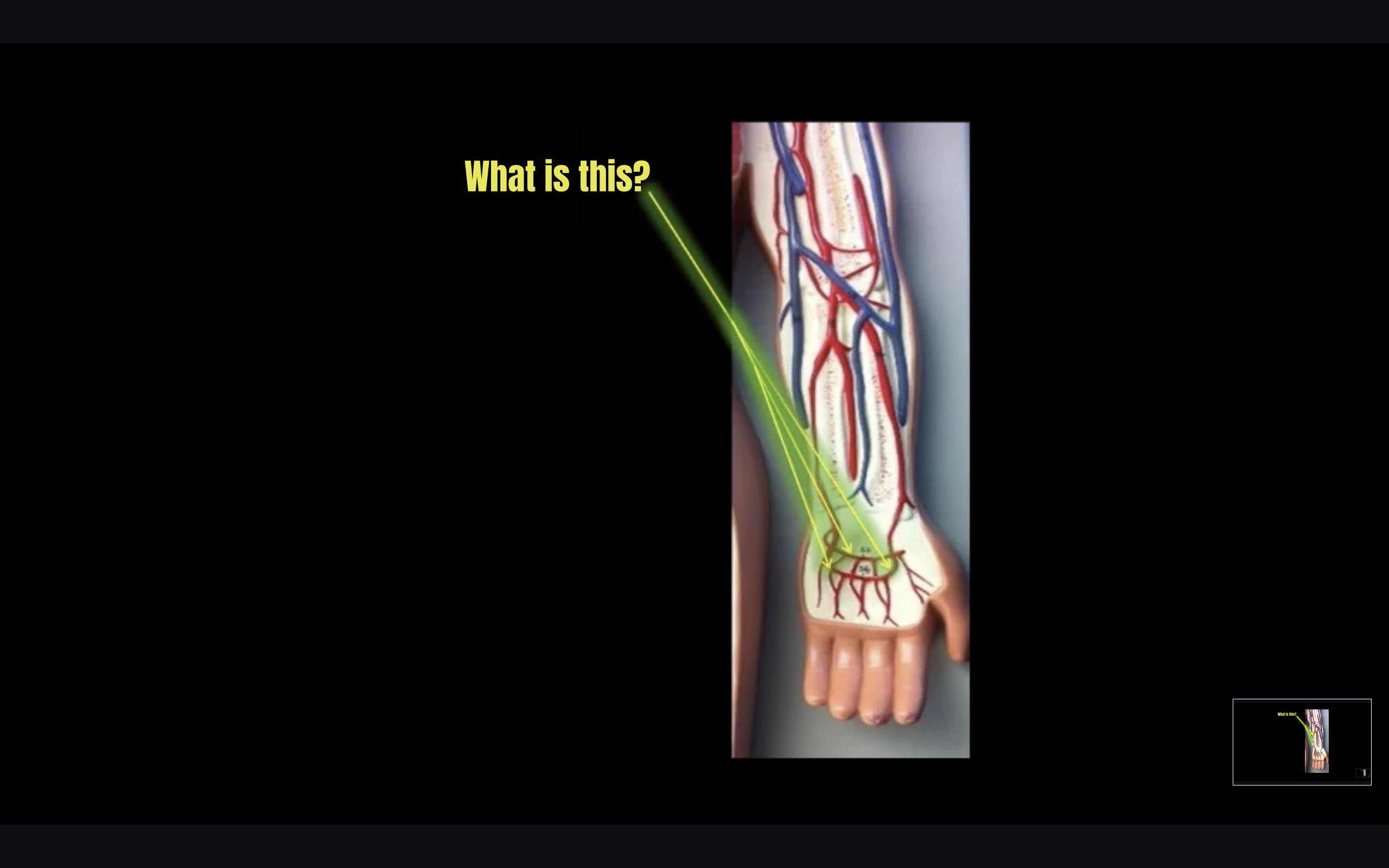 term image