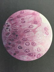 <p>Stratified epithelium with some cells appearing squamous and stratified cuboidal, and basal cells being cuboidal or columnar.</p><p>Cells are flattened while others are flattened side to side, allowing elasticity</p><p>LINES THE URETERS, BLADDER, AND PART OF THE URETHRA</p>