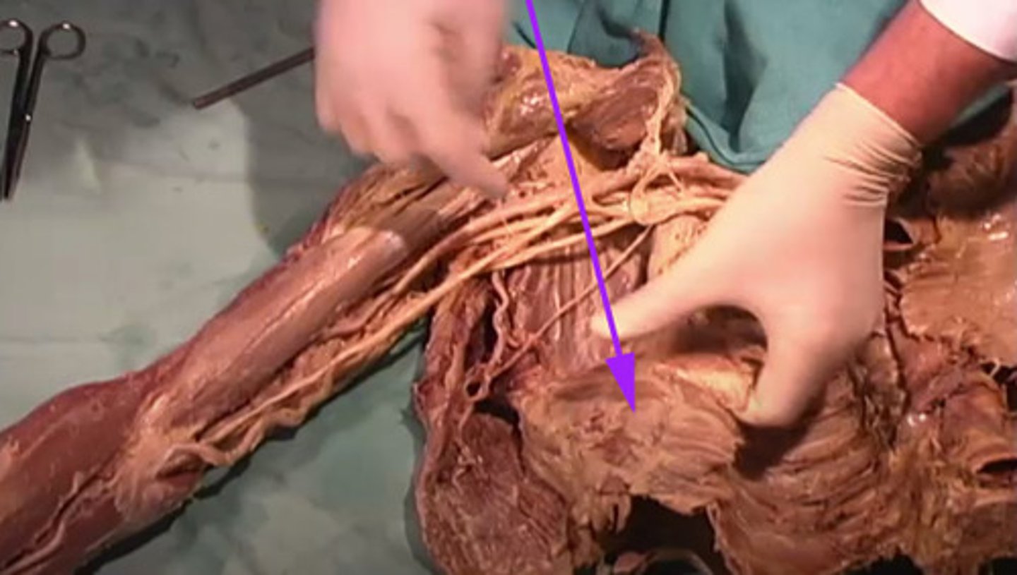 <p>Which muscle is this?</p>