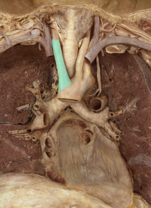 <p>Identify the feature of the arch of aorta</p>