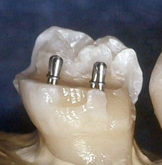<p>Identify (3) errors with this pin placement</p>