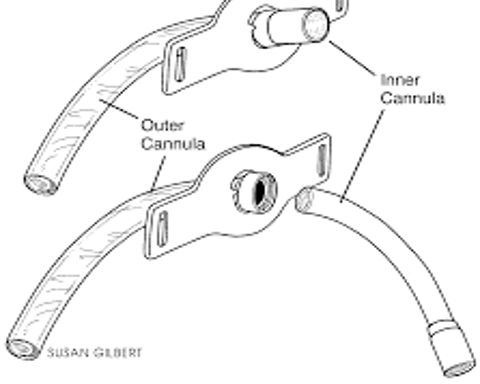 <p>what type of tracheostomy tube?</p>