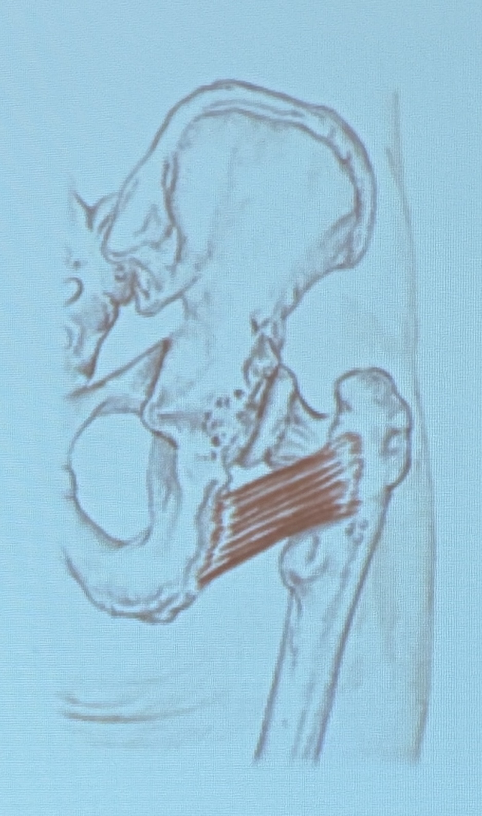 <p>Muscle name?</p>