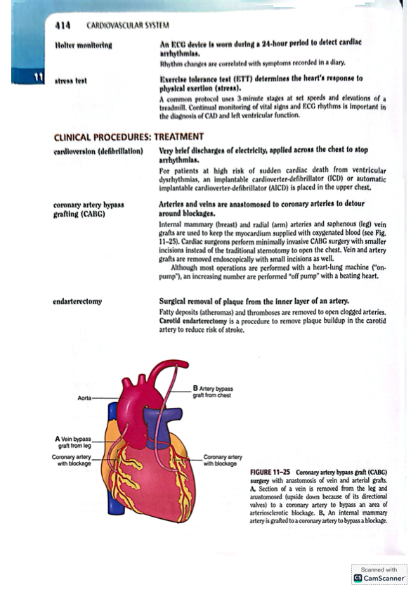 <p>coronary artery bypass grafting (CABG)</p>