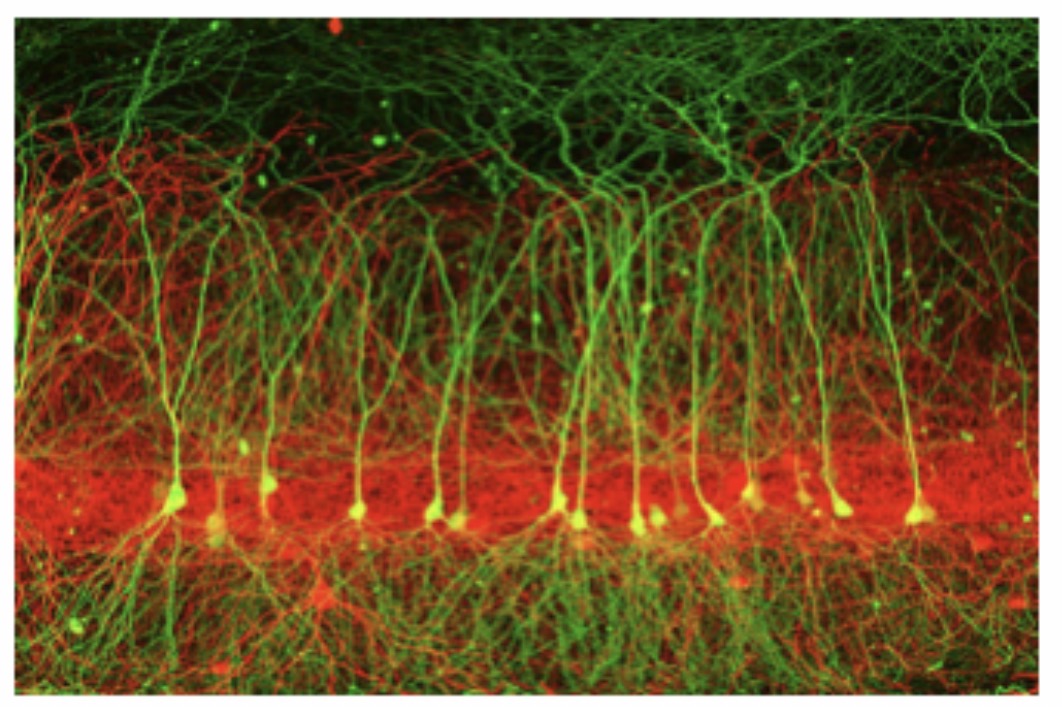 <p>Pyramidal Neuron : Function : Transmits impulses in the cerebral cortex and is involved in voluntary motor control and higher brain functions.</p>