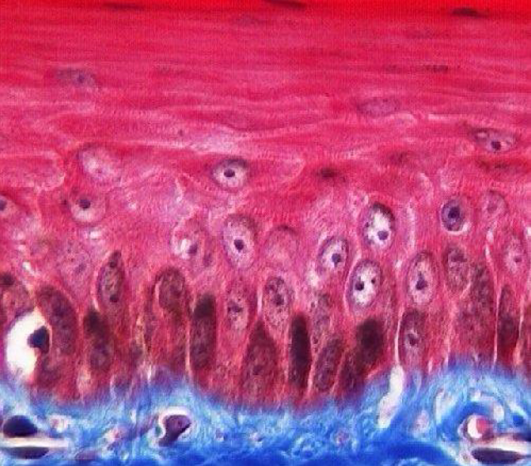 <p>What is this? (kertinized/non-keratinized)</p>