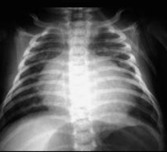 <p>Diagnosis</p>