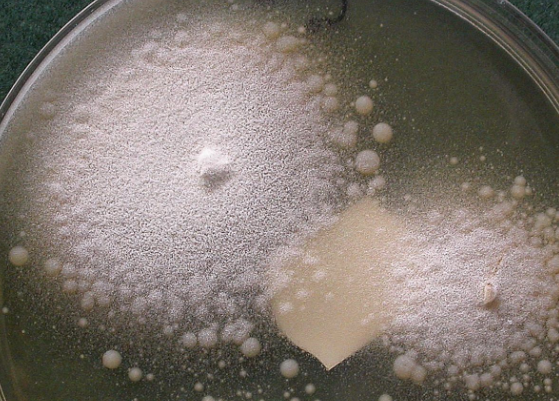 <p>tropical chronic inflammatory disease isolated to nasal mucosa. </p><p>rapid growth at 37C, glabrous becoming powdery, buff/yellowish gray front, white reverse. white satellite colonies form with age, spores forcibly discharged by sporangiophores fill sides of inoculated tubes &amp; plates</p>