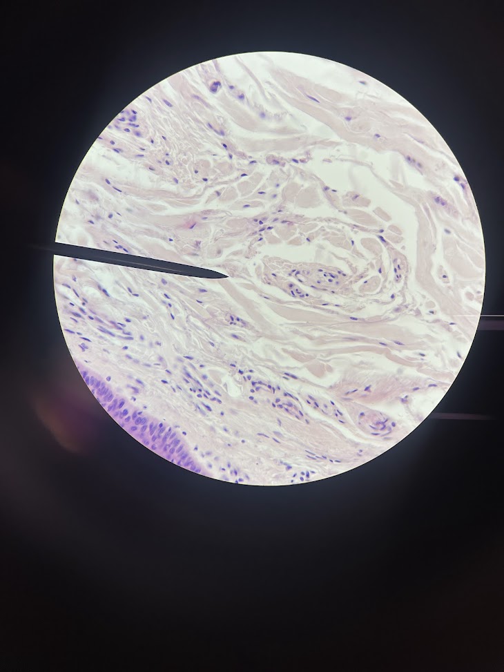 <p>tissue type</p>