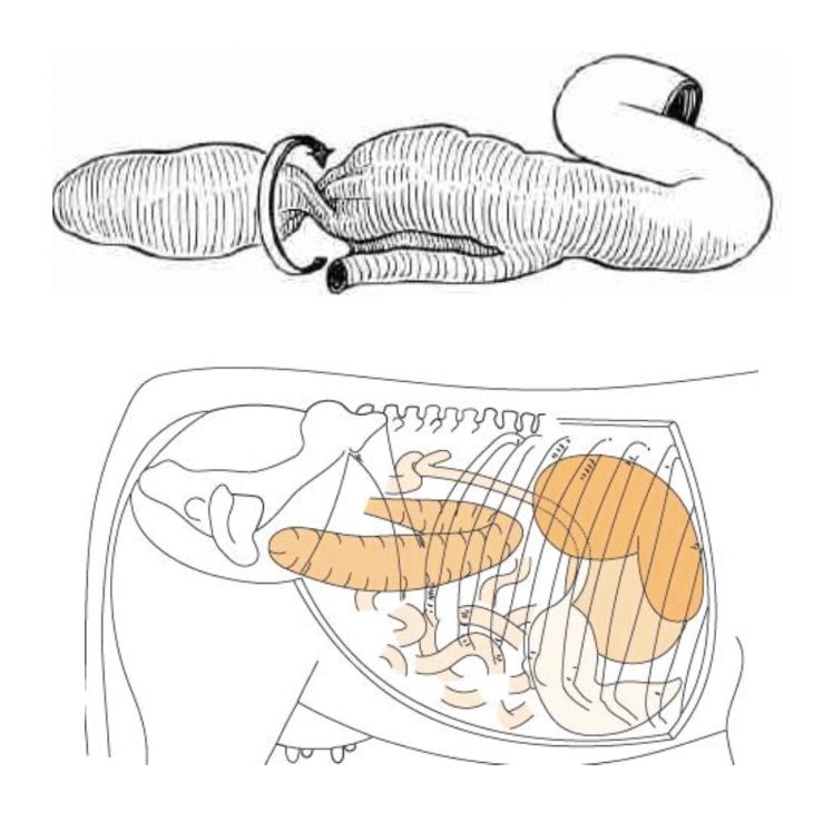 <p><u>Seasonality:</u> More variable than LDA/RDA</p><p><u>Clinical Signs:</u> As for RDA</p><ul><li><p>Fluid sounds more caudodorsal than RDA (ventral to short ribs on RIGHT side)</p></li><li><p>French load palpated on rectal exam projecting into pelvis = Distal end of caecum OR curve of flipped caecum</p></li></ul><p><u>Risk:</u> High VFAs in circulation</p>