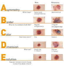 <p>A (asymmetry), B (borders), C (color varies), D (diameter > pencil eraser), E (evolution).</p>